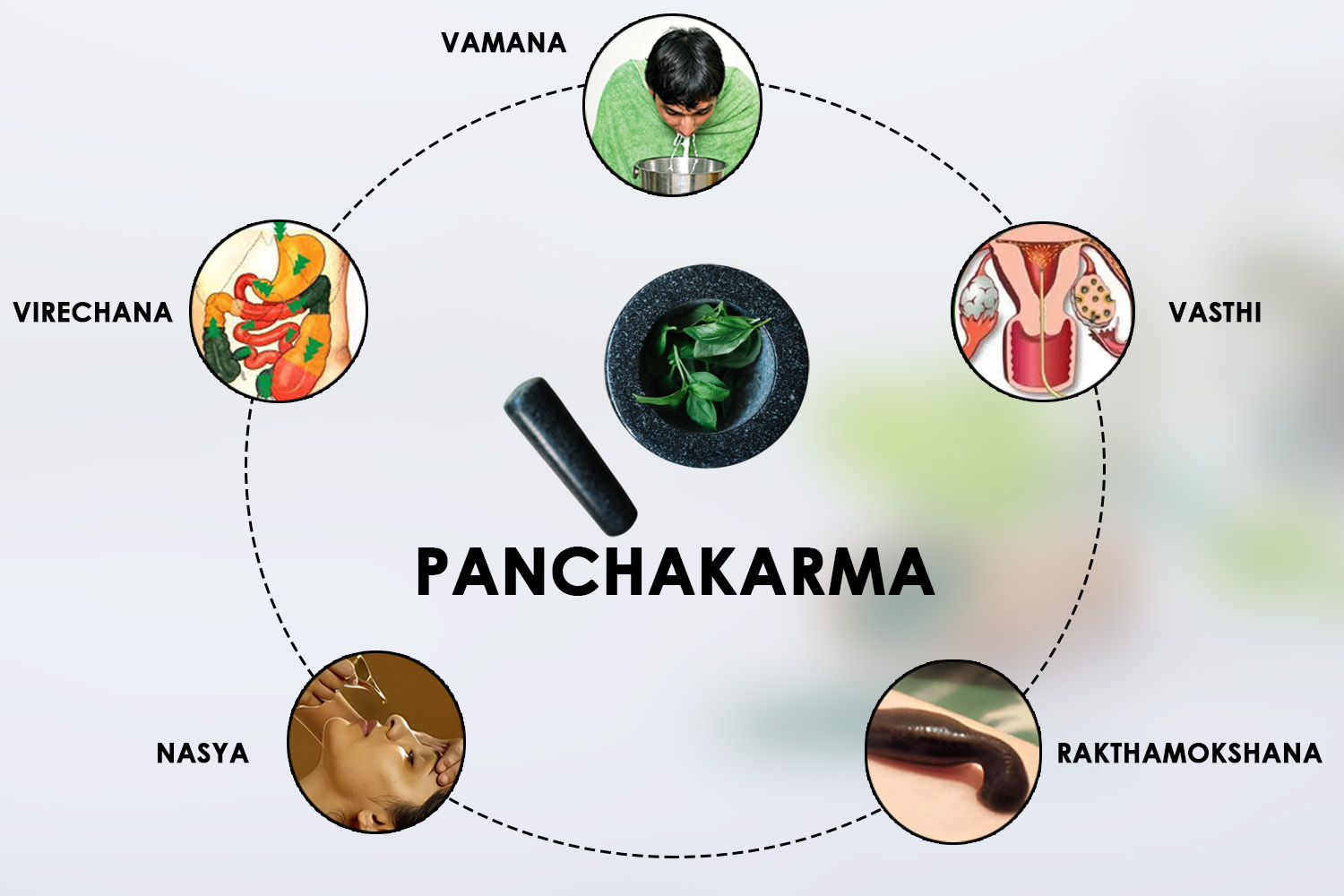 Panchakarma